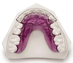 Orthodontics_Hawley_Retainer_with_Ball_Clasps