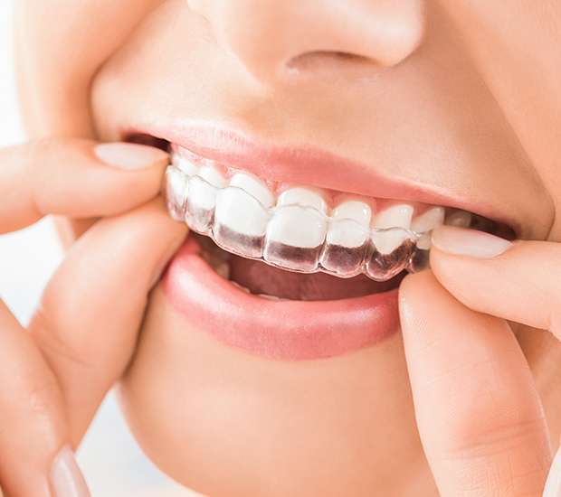 Toluca Lake Does Invisalign Really Work?