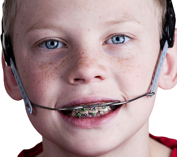Toluca Lake Orthodontic Headgear