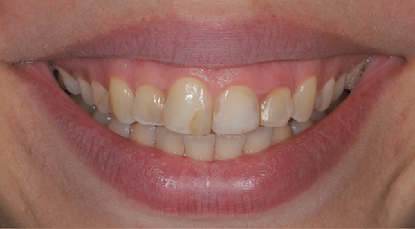 An Orthodontist&#    ;s Role In A Smile Makeover